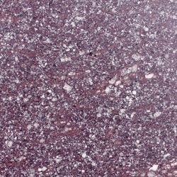 PORPHYRY